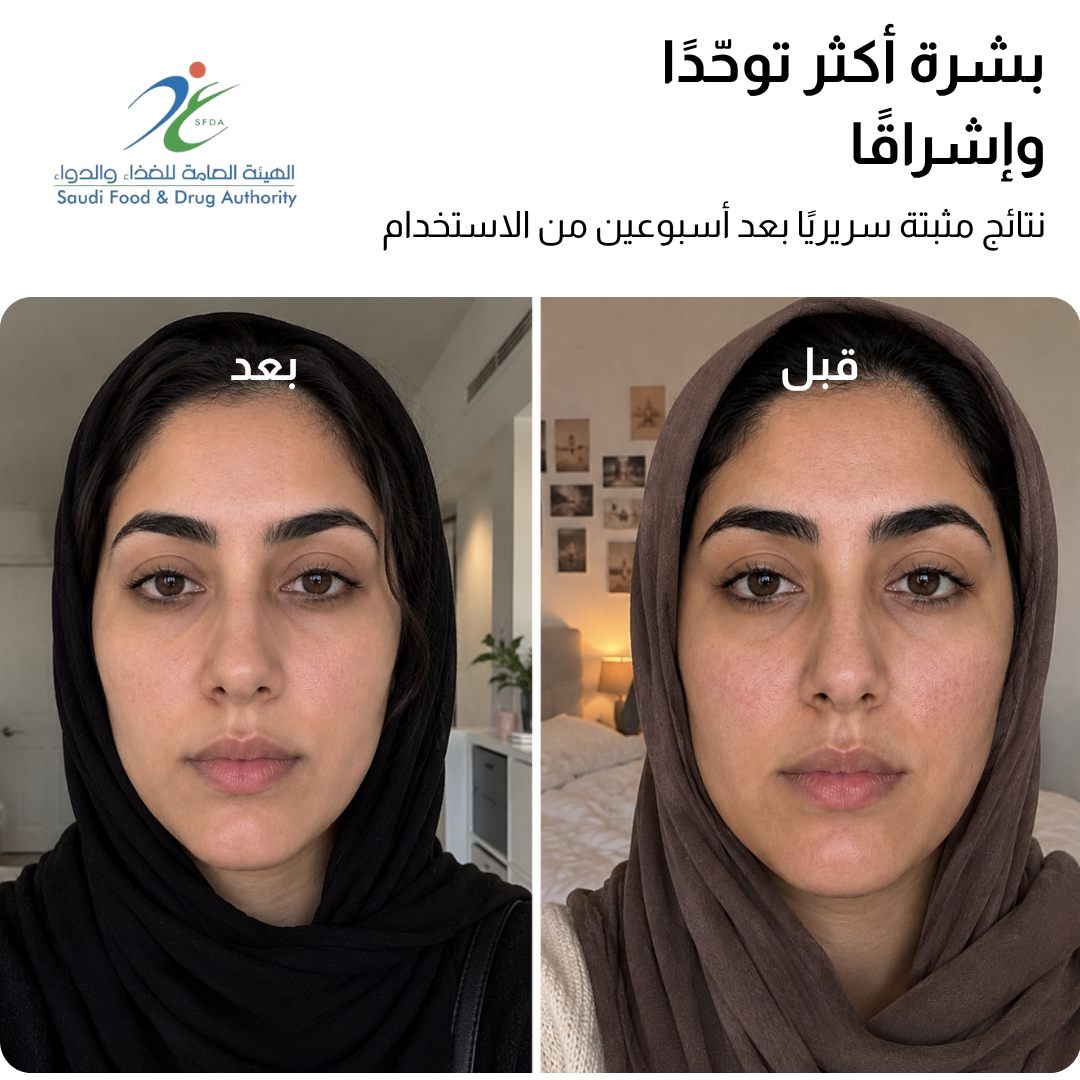 قناع JOVS 4D بالليزر