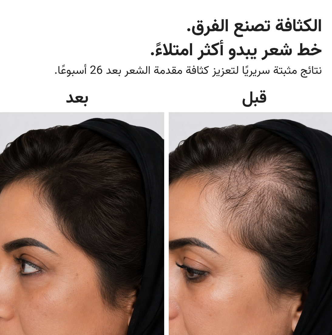 قبعة HairMax ليزر 272