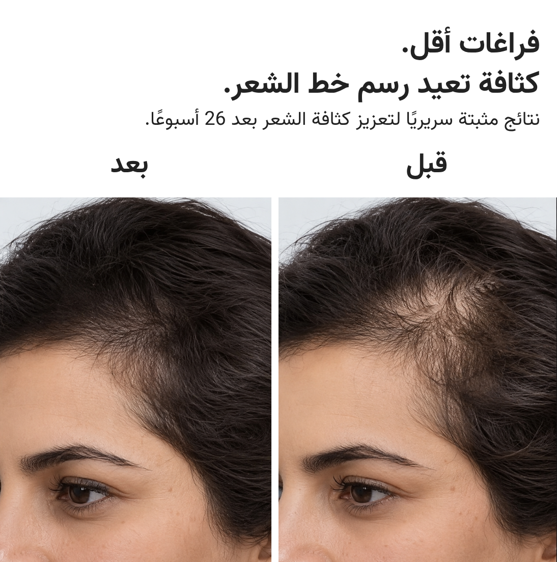 قبعة HairMax ليزر 272