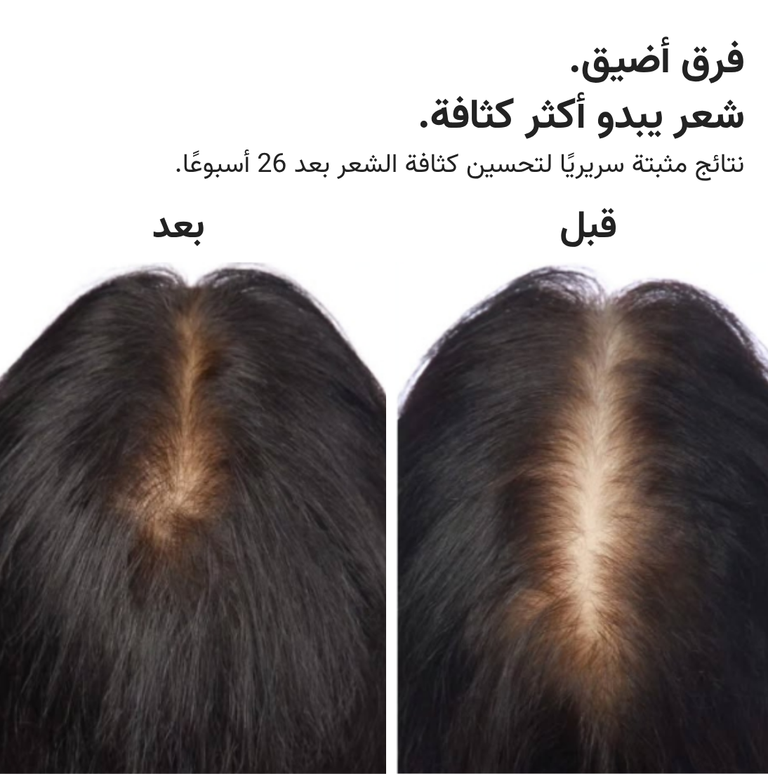 قبعة HairMax ليزر 272