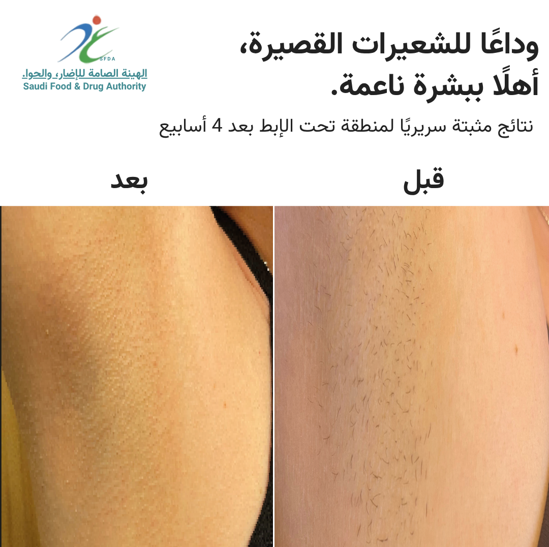 سموث سكين بيور سويتش IPL
