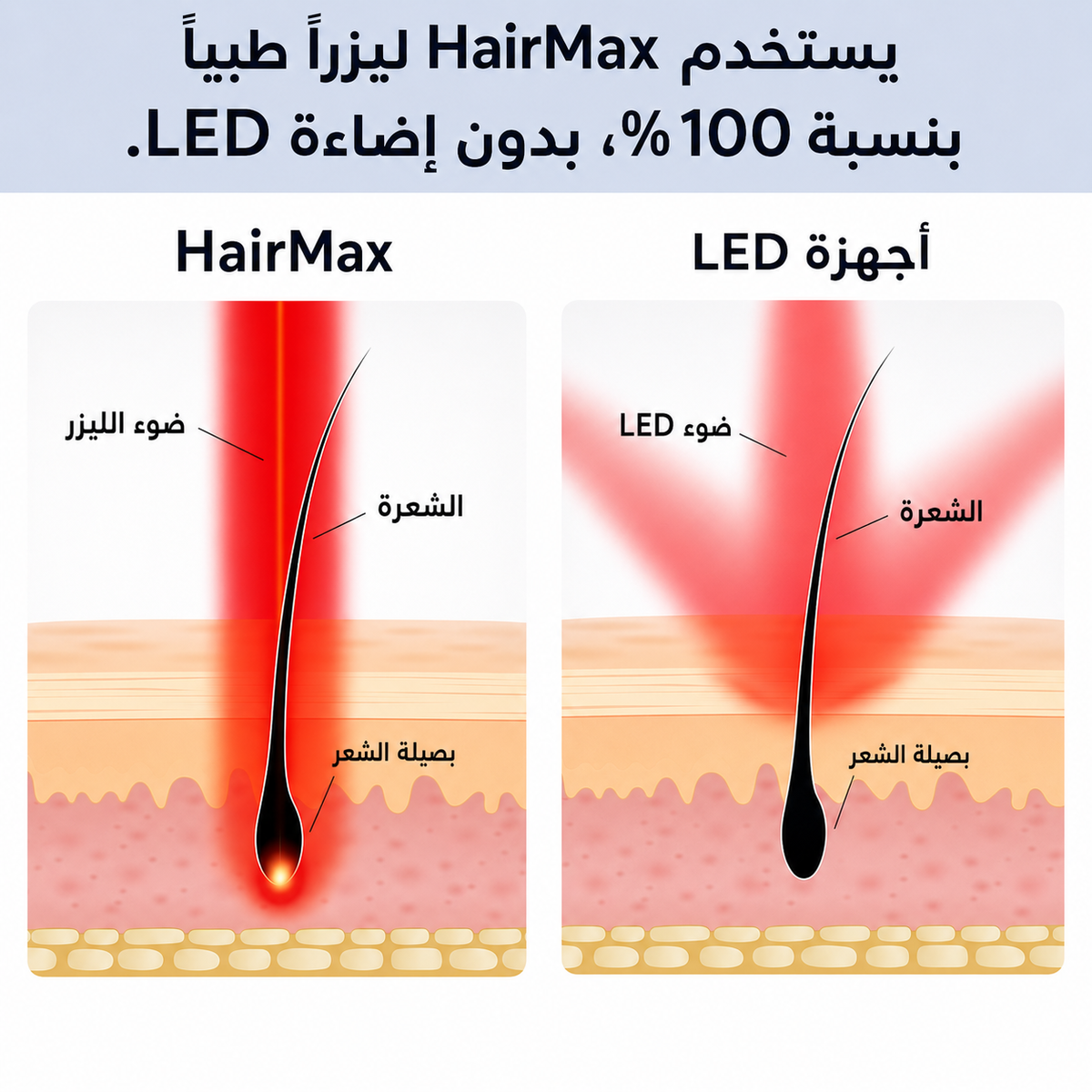 قبعة HairMax ليزر 272