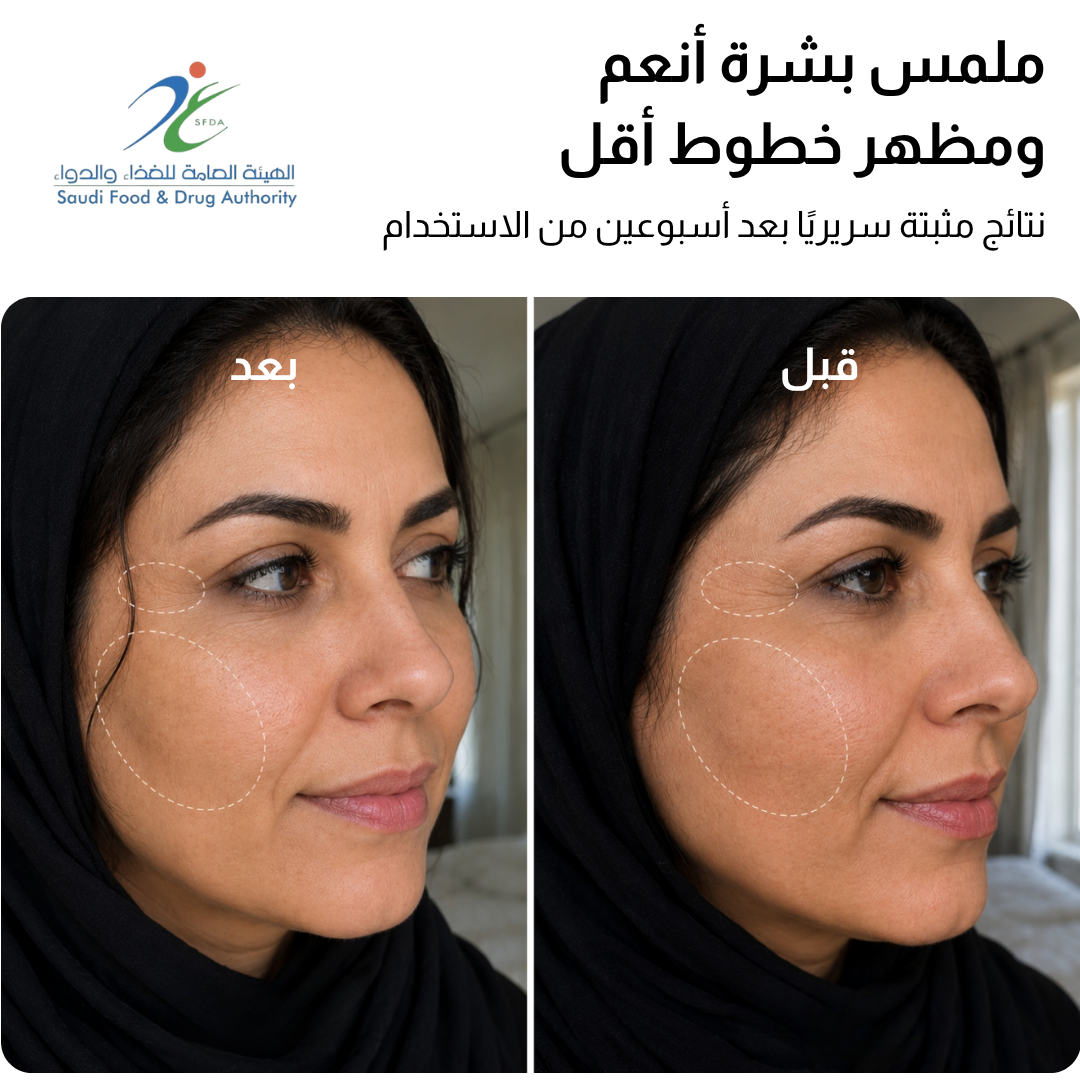 قناع JOVS 4D بالليزر