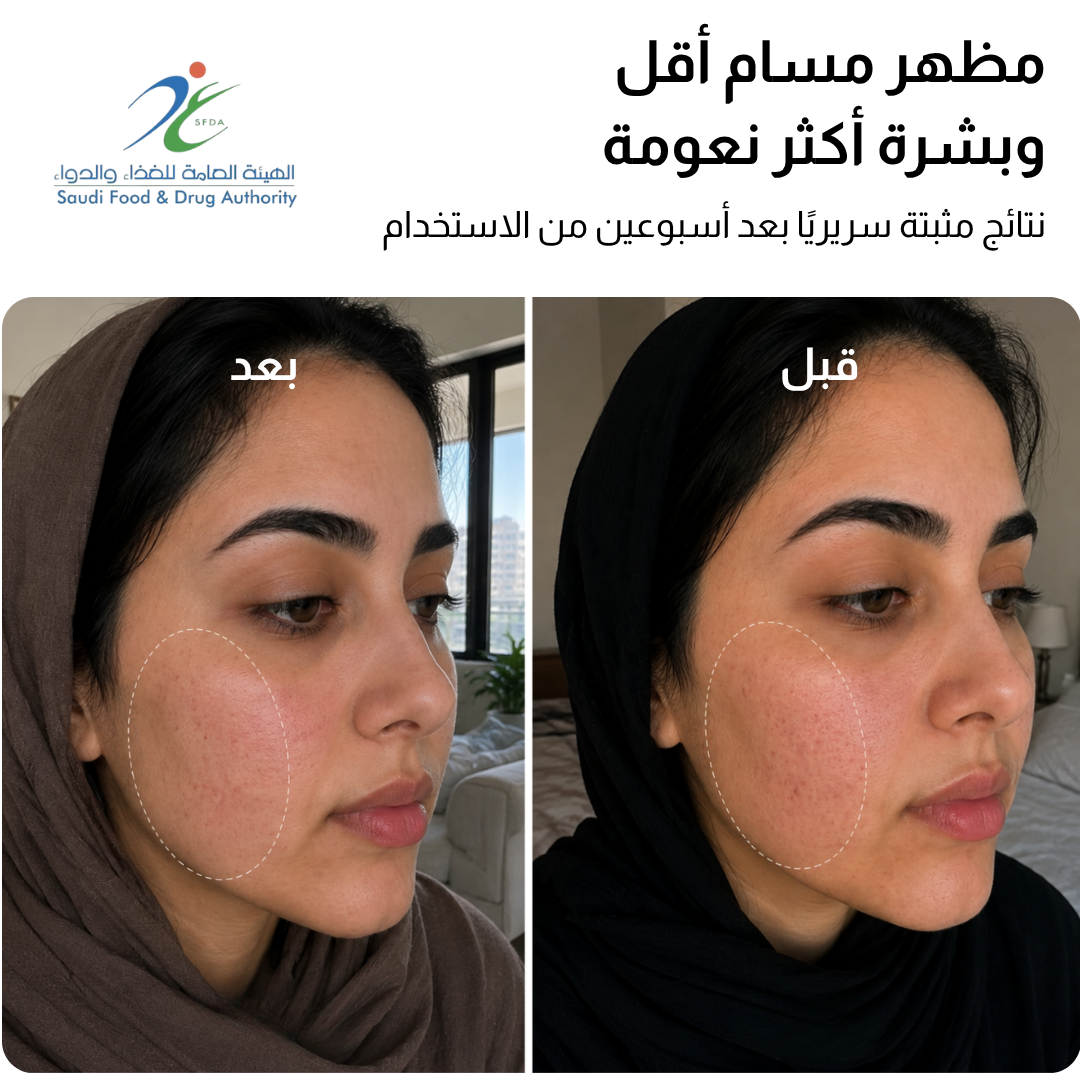 قناع JOVS 4D بالليزر