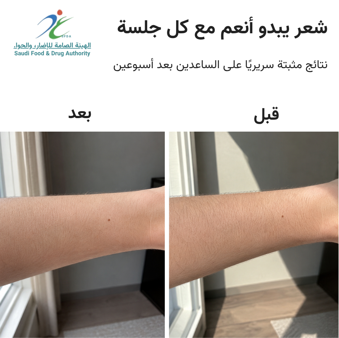 سموث سكين بيور سويتش IPL