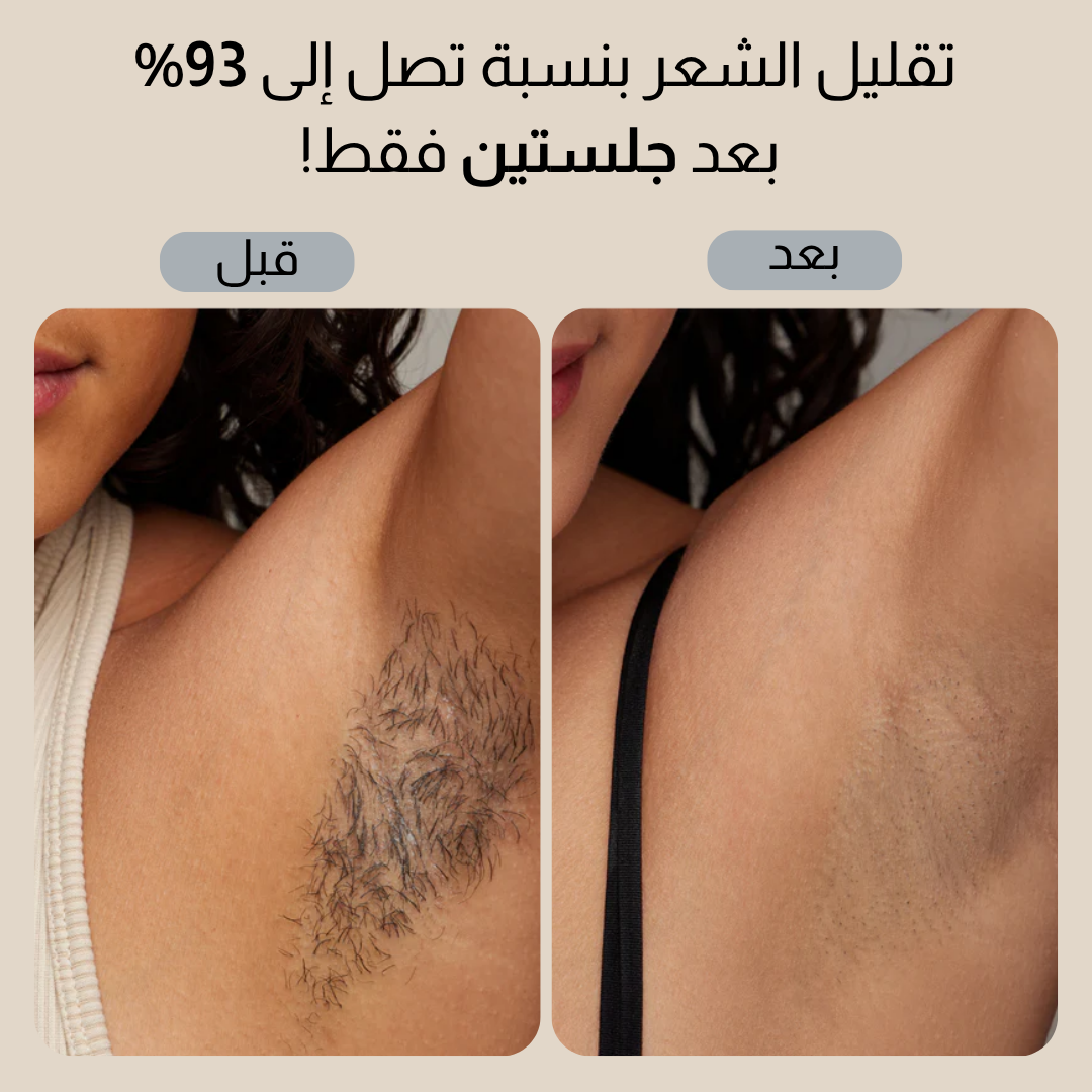 سموث سكين بيور سويتش IPL