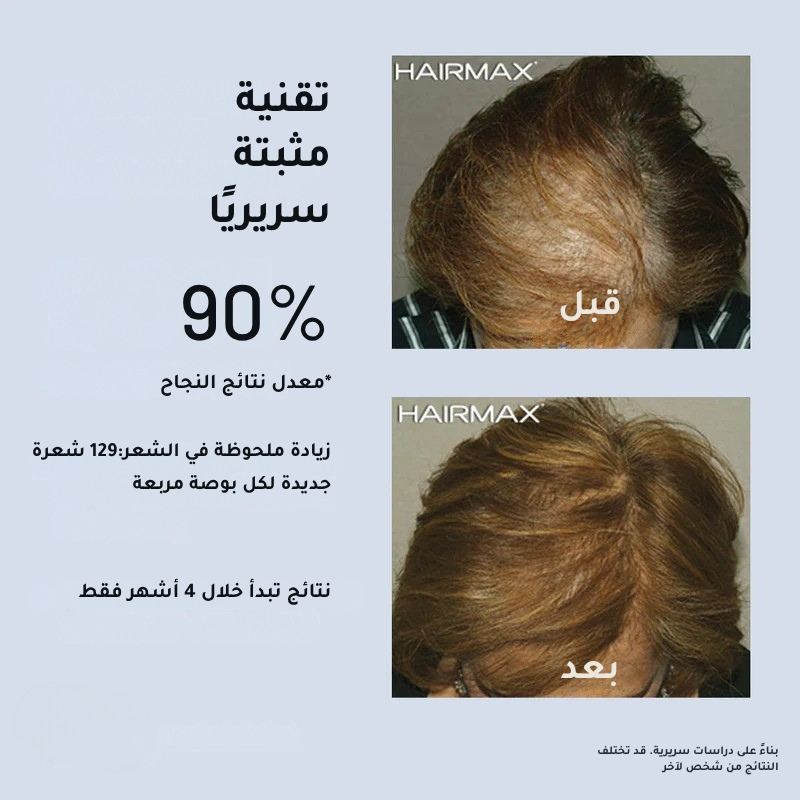 HairMax ليزر باند 82