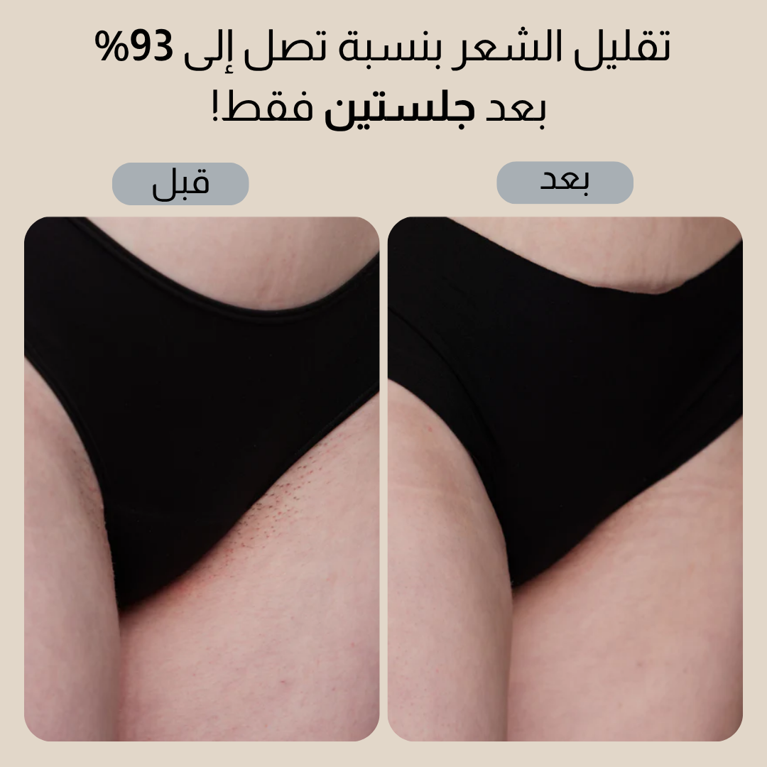 سموث سكين بيور سويتش IPL
