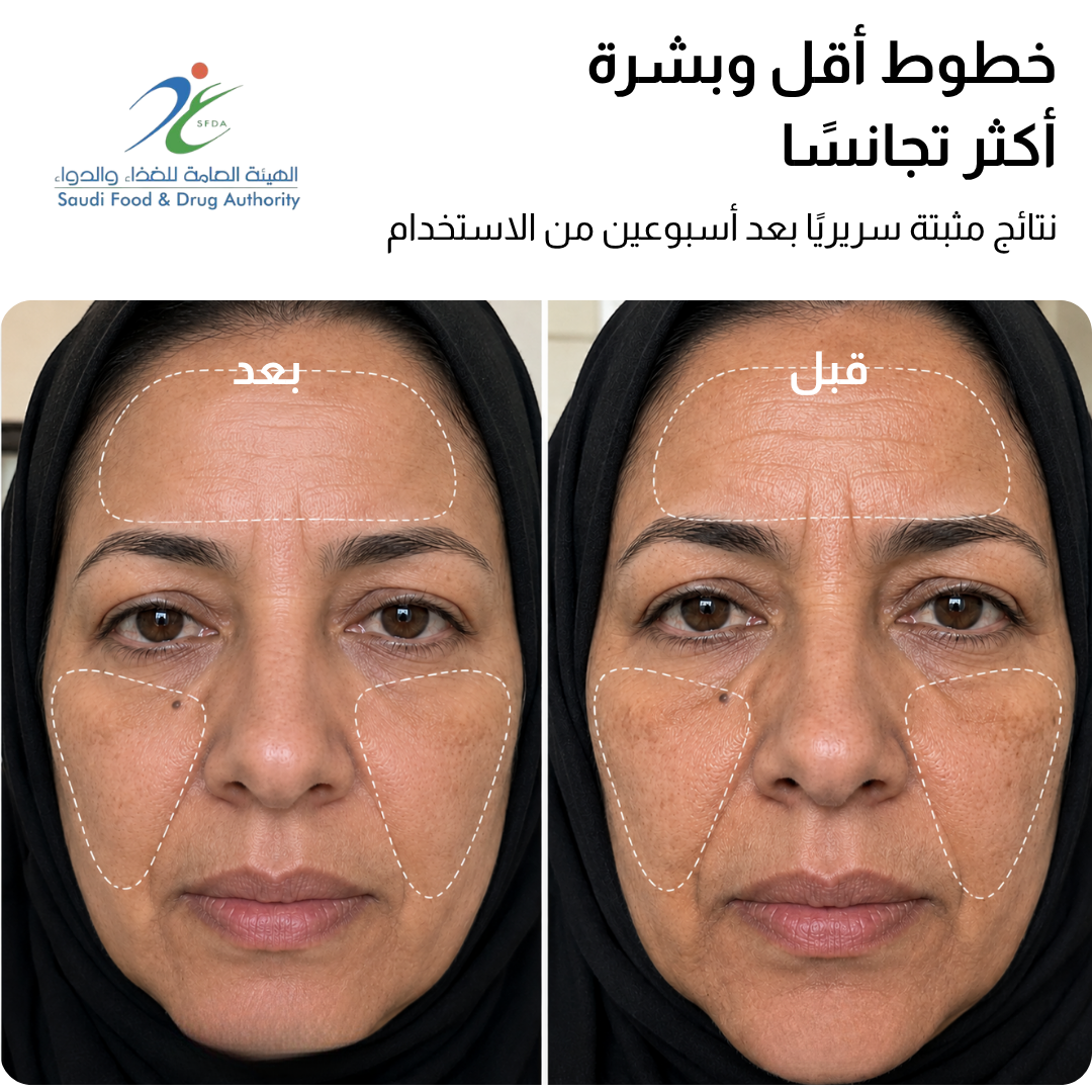 قناع JOVS 4D بالليزر