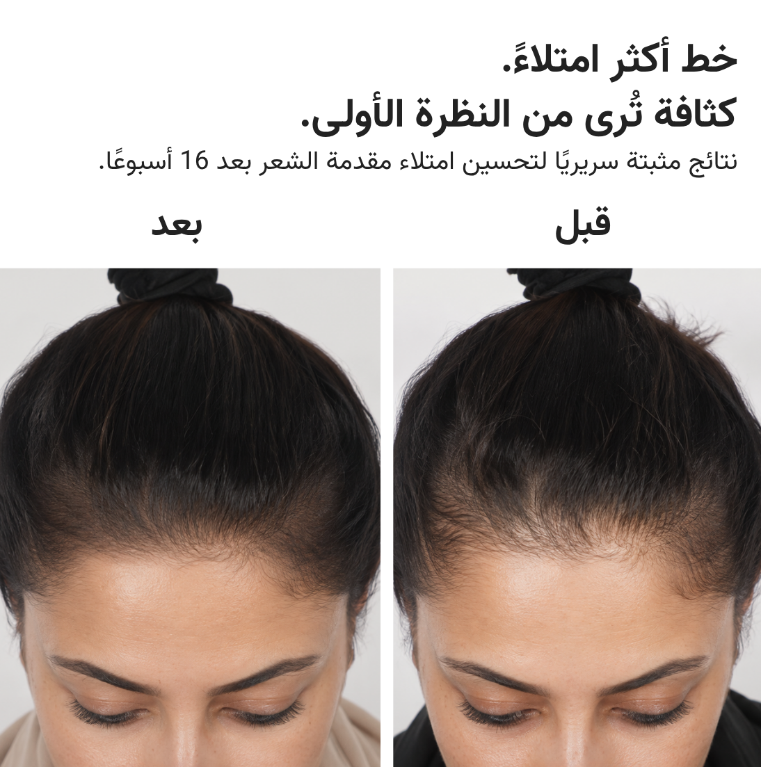قبعة HairMax ليزر 272