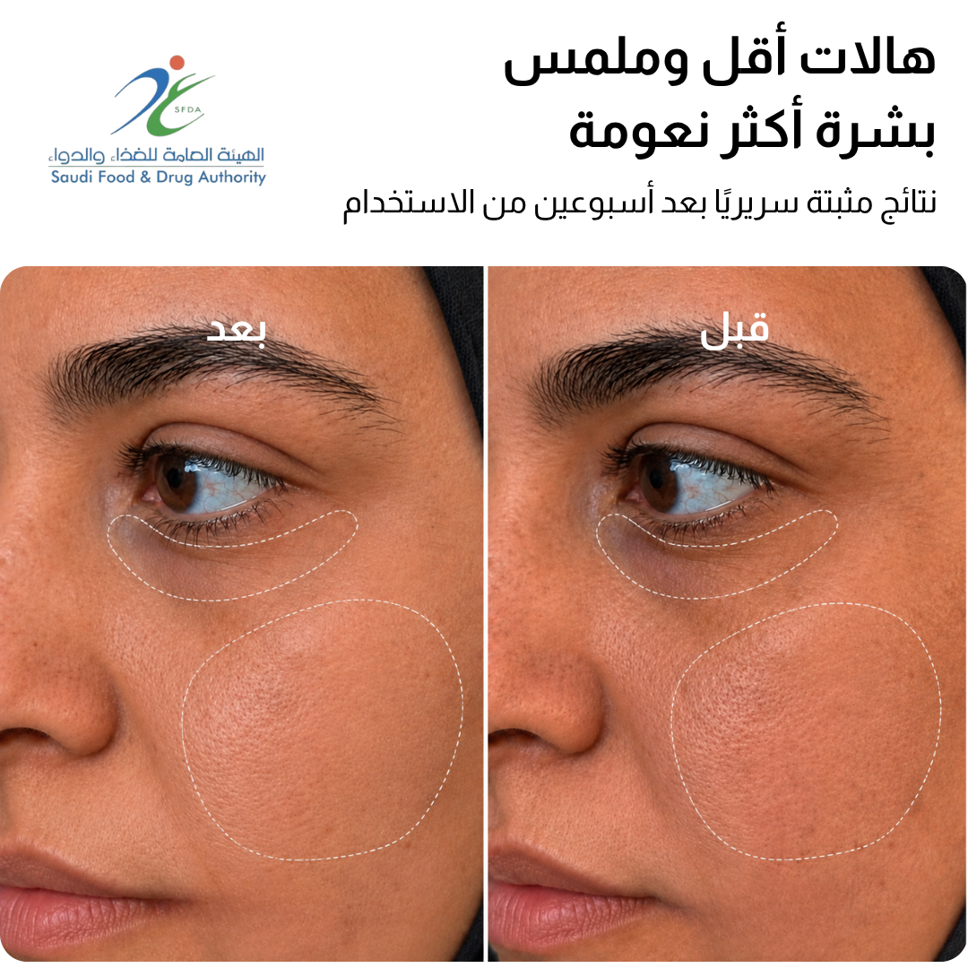قناع JOVS 4D بالليزر