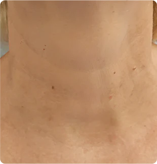 After image