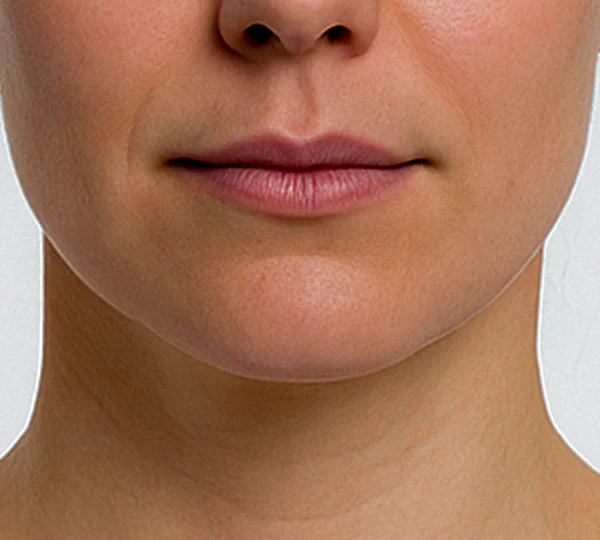 After image