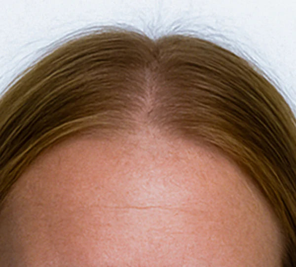 Before image