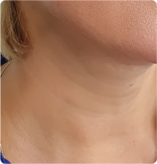 After image